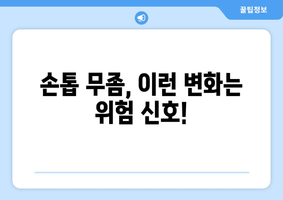 손톱 무좀, 초기 증상 놓치지 말고 확인하세요! | 손톱 변색, 두꺼워짐, 갈라짐, 무좀 치료