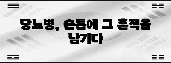 손톱 줄무늬 | 당뇨병의 숨겨진 징후 발견
